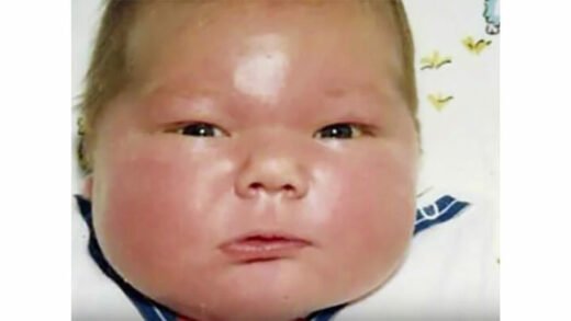 baby-who-weighed-16-pounds-in-1983-is-now-an-adult-and-still-known-for-his-huge-size