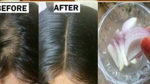 homemade-onion-recipe-for-hair:-boost-growth-and-strength-naturally