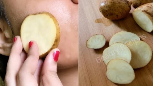 i-rubbed-potato-on-my-face-&-it-removed-my-dark-spots-and-hyperpigmentation