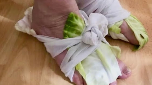 cabbage-wraps:-a-simple-re.medy-for-swollen-joints-and-thyroid-issues