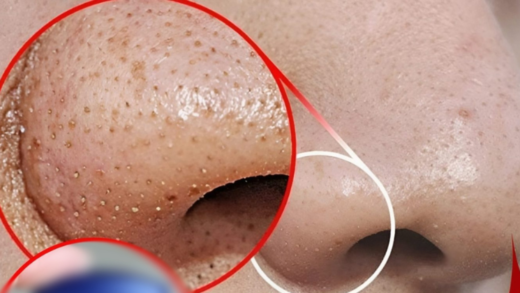 remove-blackheads-on-your-nose-with-just-a-mixture-of-vaseline-and-this-cheap-and-easy-to-find-ingredient